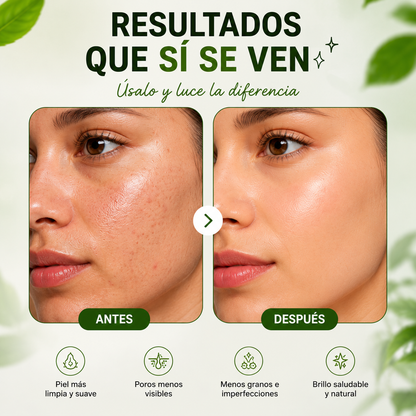 Stick Purificante de Té Verde para Poros y Puntos Negros